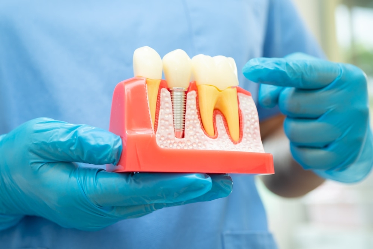 Featured image for “Starting Invisalign? Here’s What Albuquerque Residents Need to Know Before Your First Tray”