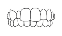 Dental illustration showing straight upper and lower teeth alignment in front view.