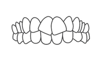 Straight teeth alignment diagram showing proper dental occlusion and bite positioning.